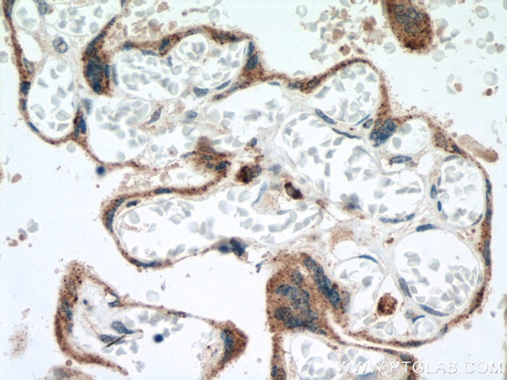 IHC staining of human placenta using 10864-2-AP