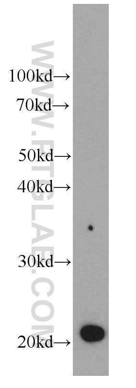 WB analysis of HeLa using 66080-1-Ig (same clone as 66080-1-PBS)