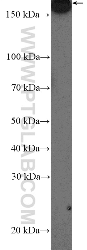 WB analysis of HeLa using 26456-1-AP