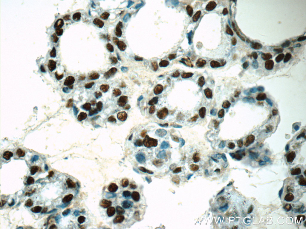 IHC staining of human thyroid using 15575-1-AP