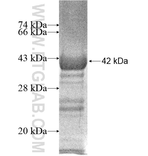 GMCL1L fusion protein Ag10631 SDS-PAGE GMCL1L fusion protein Ag10631 SDS-PAGE