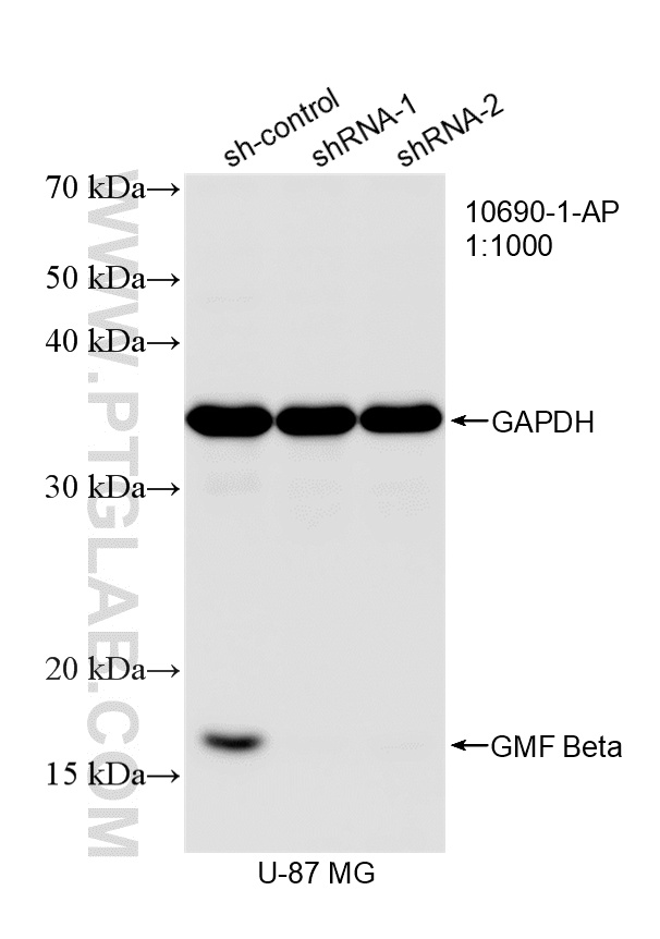 WB analysis of U-87 MG using 10690-1-AP WB analysis of U-87 MG using 10690-1-AP