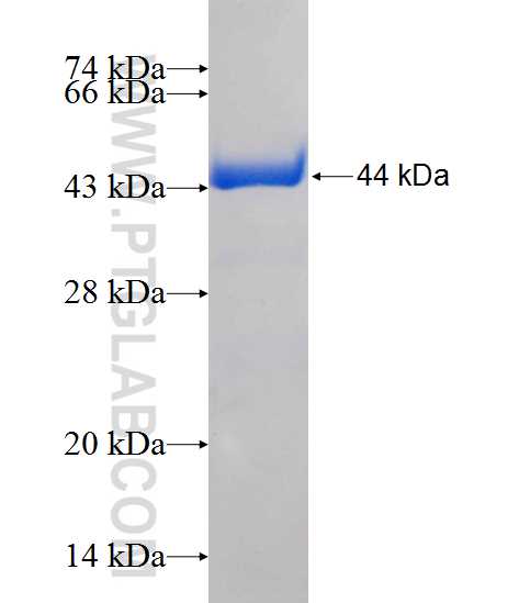 GMFB fusion protein Ag1104 SDS-PAGE