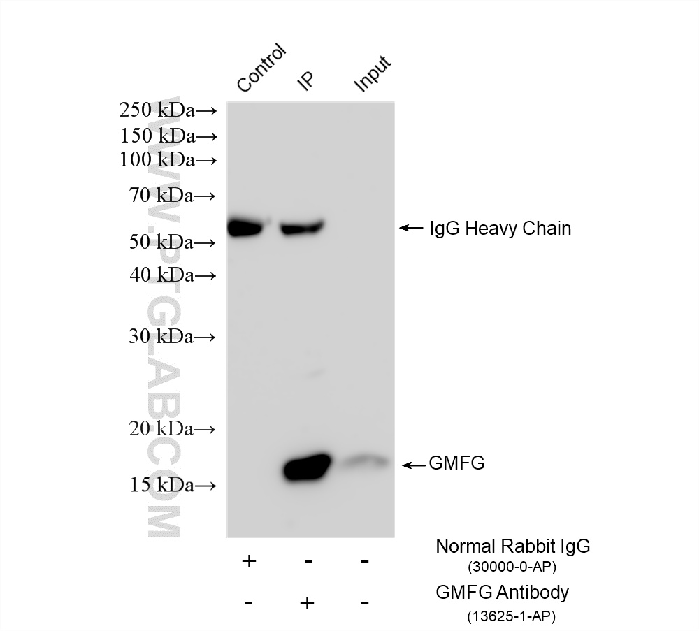 IP experiment of mouse spleen using 13625-1-AP (same clone as 13625-1-PBS) IP experiment of mouse spleen using 13625-1-AP (same clone as 13625-1-PBS)