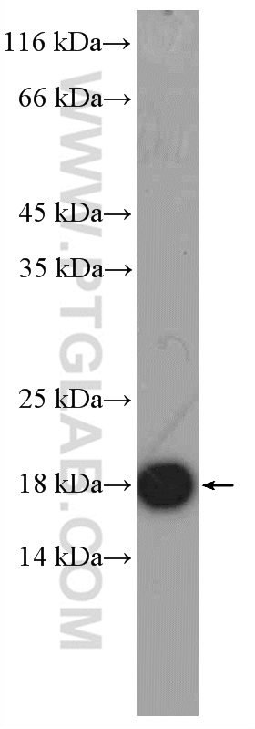 WB analysis of rat brain using 13625-1-AP