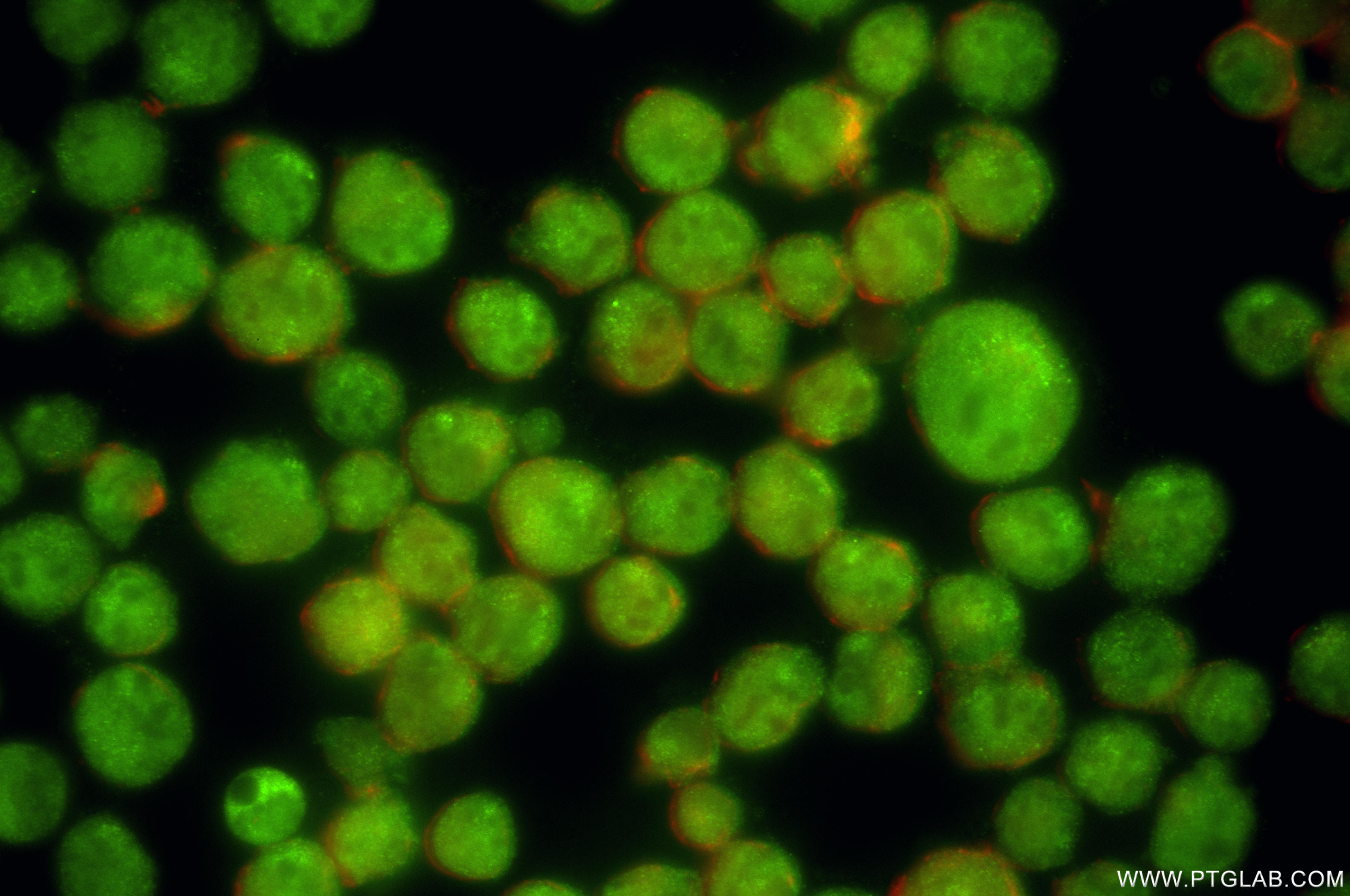 IF Staining of K-562 using 86101-2-RR (same clone as 86101-2-PBS)