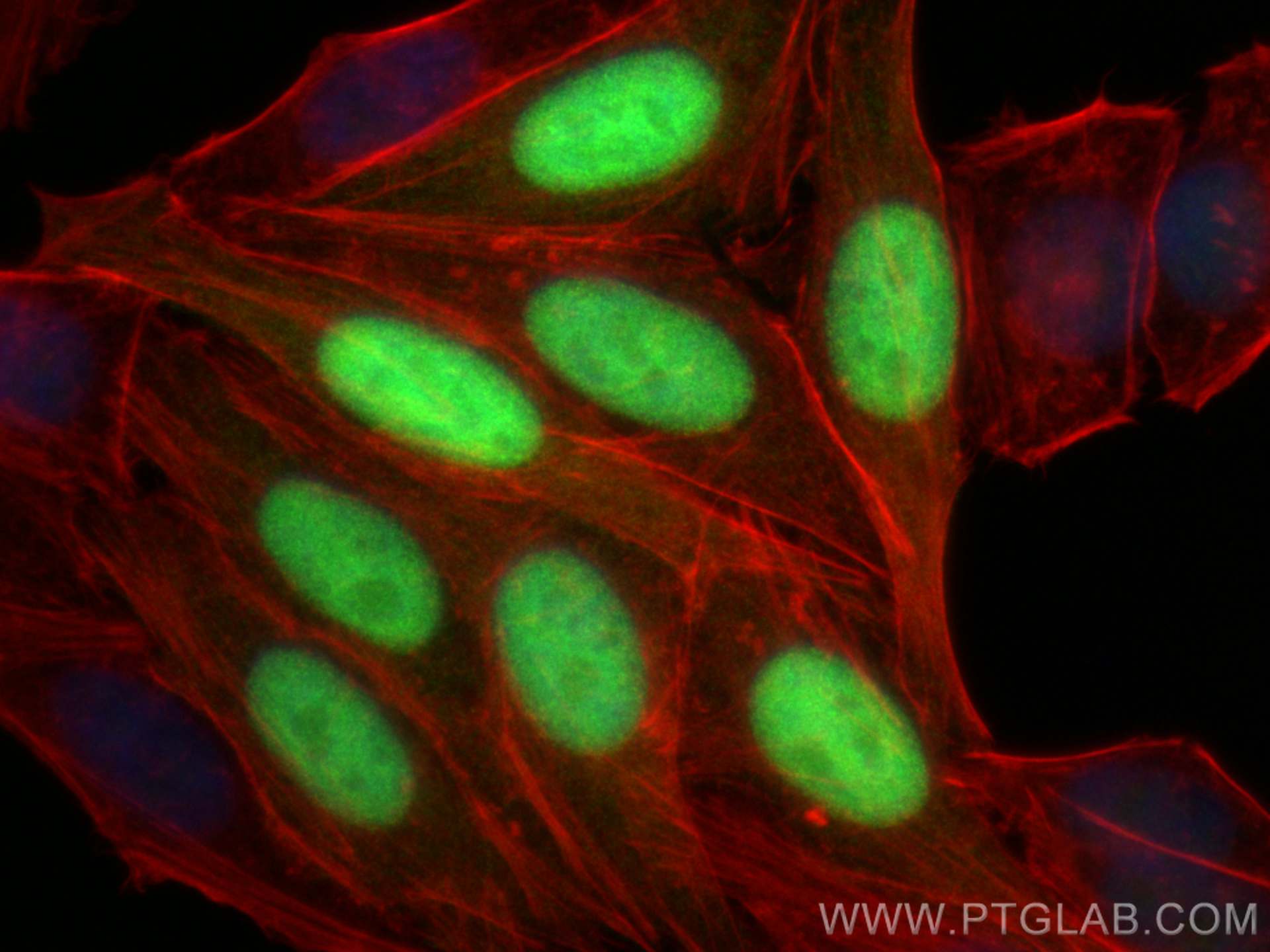 IF Staining of HepG2 using 10802-1-AP