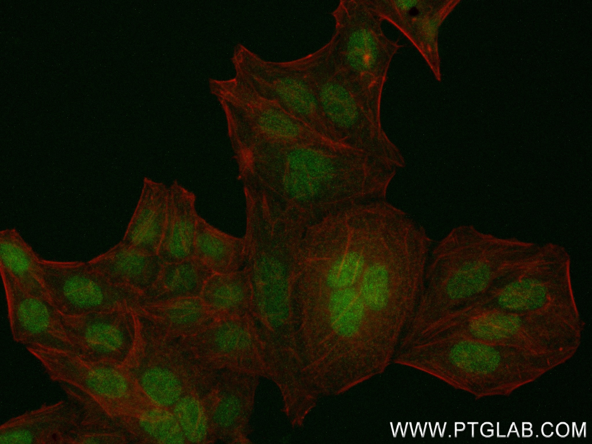 IF Staining of HepG2 using 84199-1-RR (same clone as 84199-1-PBS)