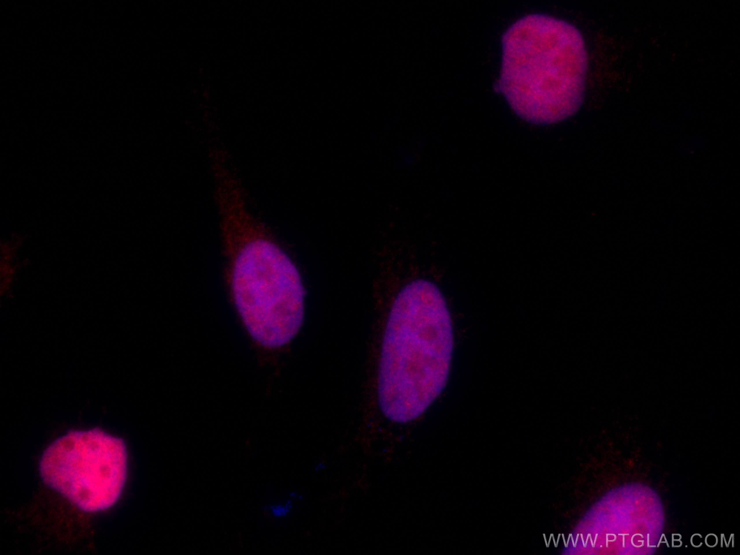 IF Staining of HeLa using CL594-66566