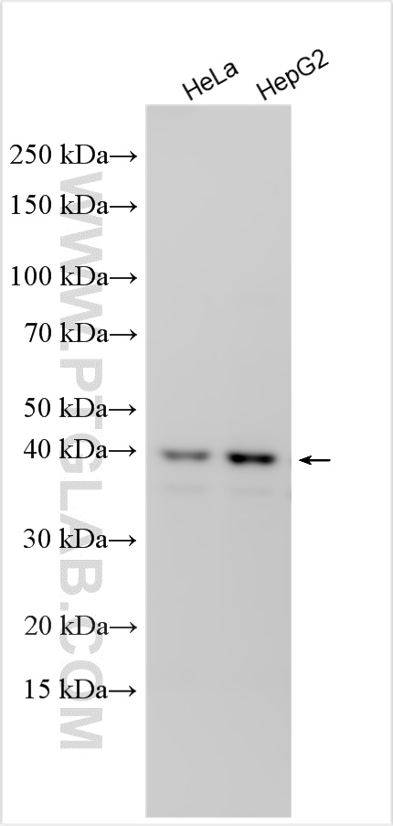 GNA12