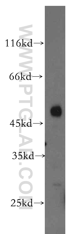 WB analysis of human testis using 15142-1-AP