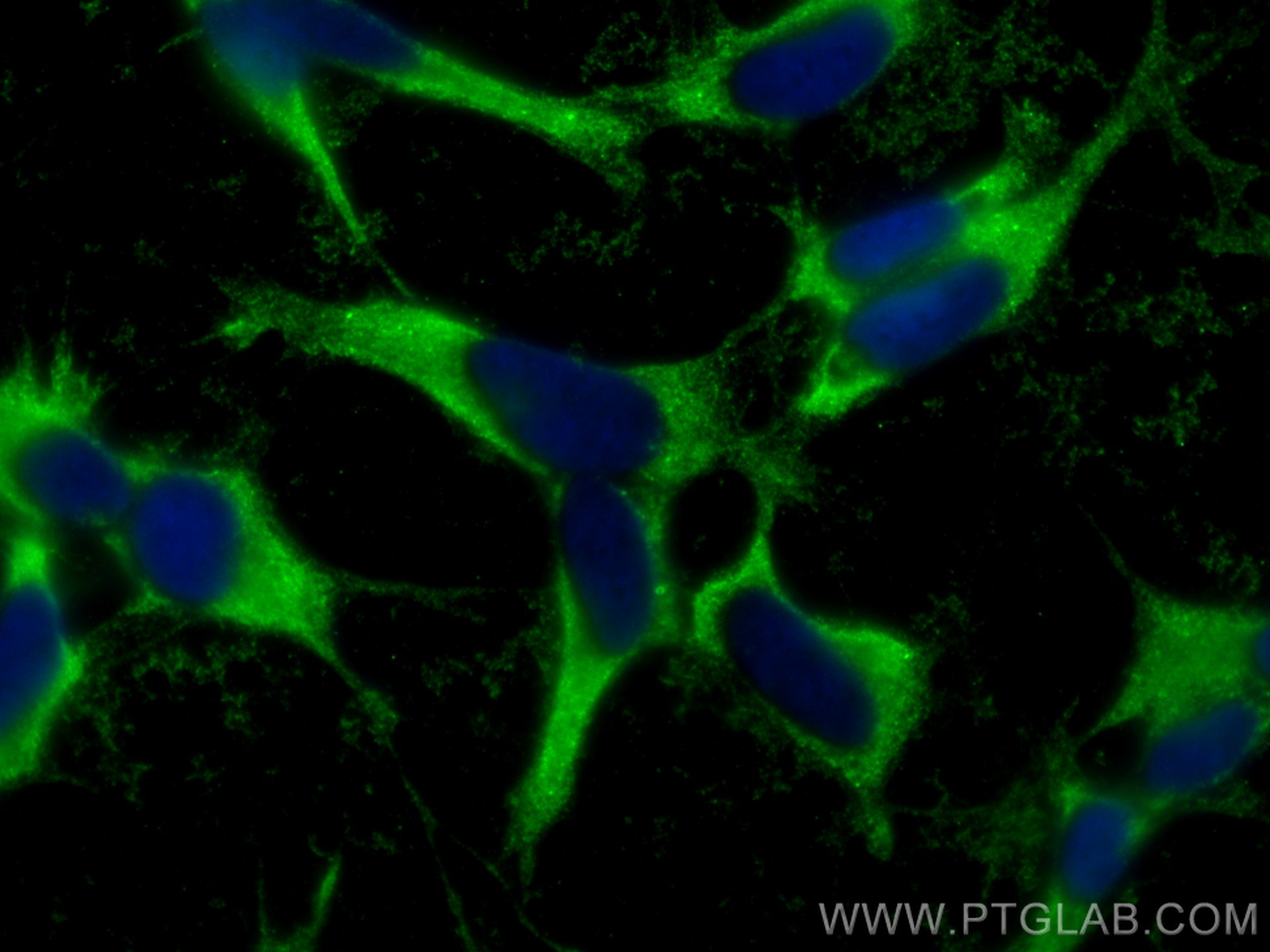 IF Staining of SH-SY5Y using 67188-1-Ig