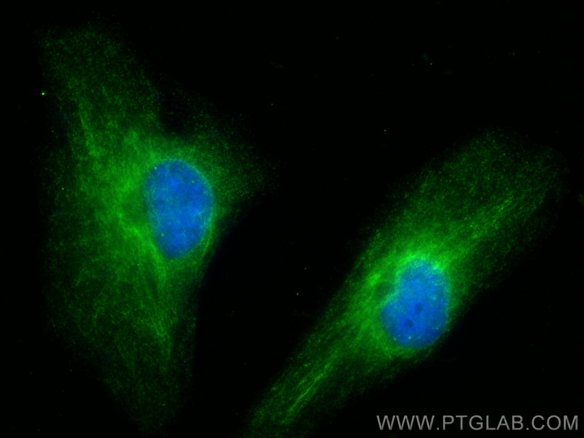 IF Staining of HeLa using 13350-1-AP