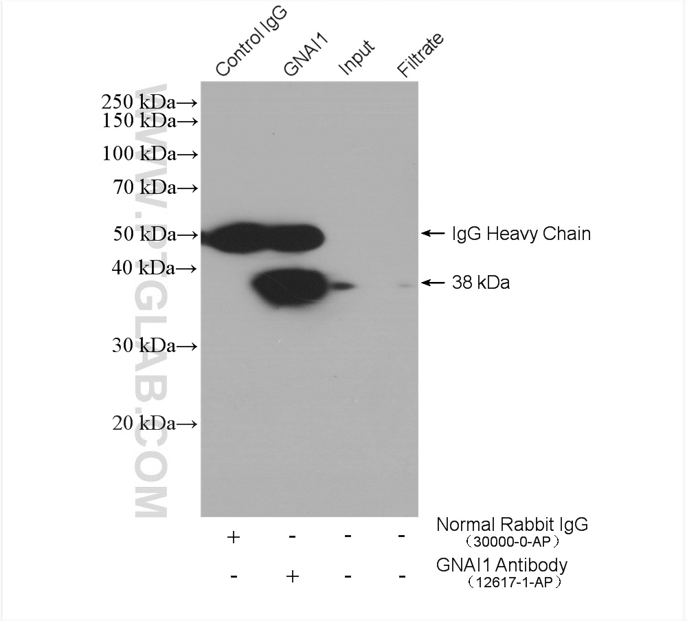 IP experiment of SH-SY5Y using 12617-1-AP