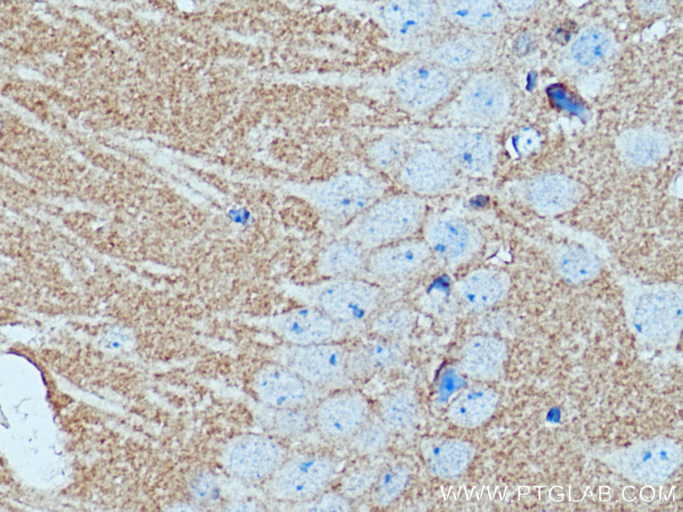 IHC staining of mouse brain using 11136-1-AP