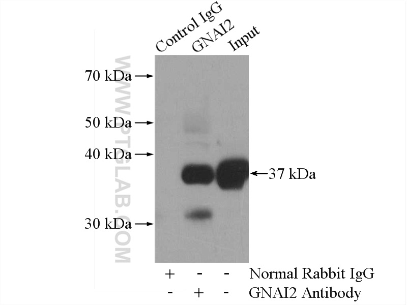 IP experiment of mouse brain using 11136-1-AP