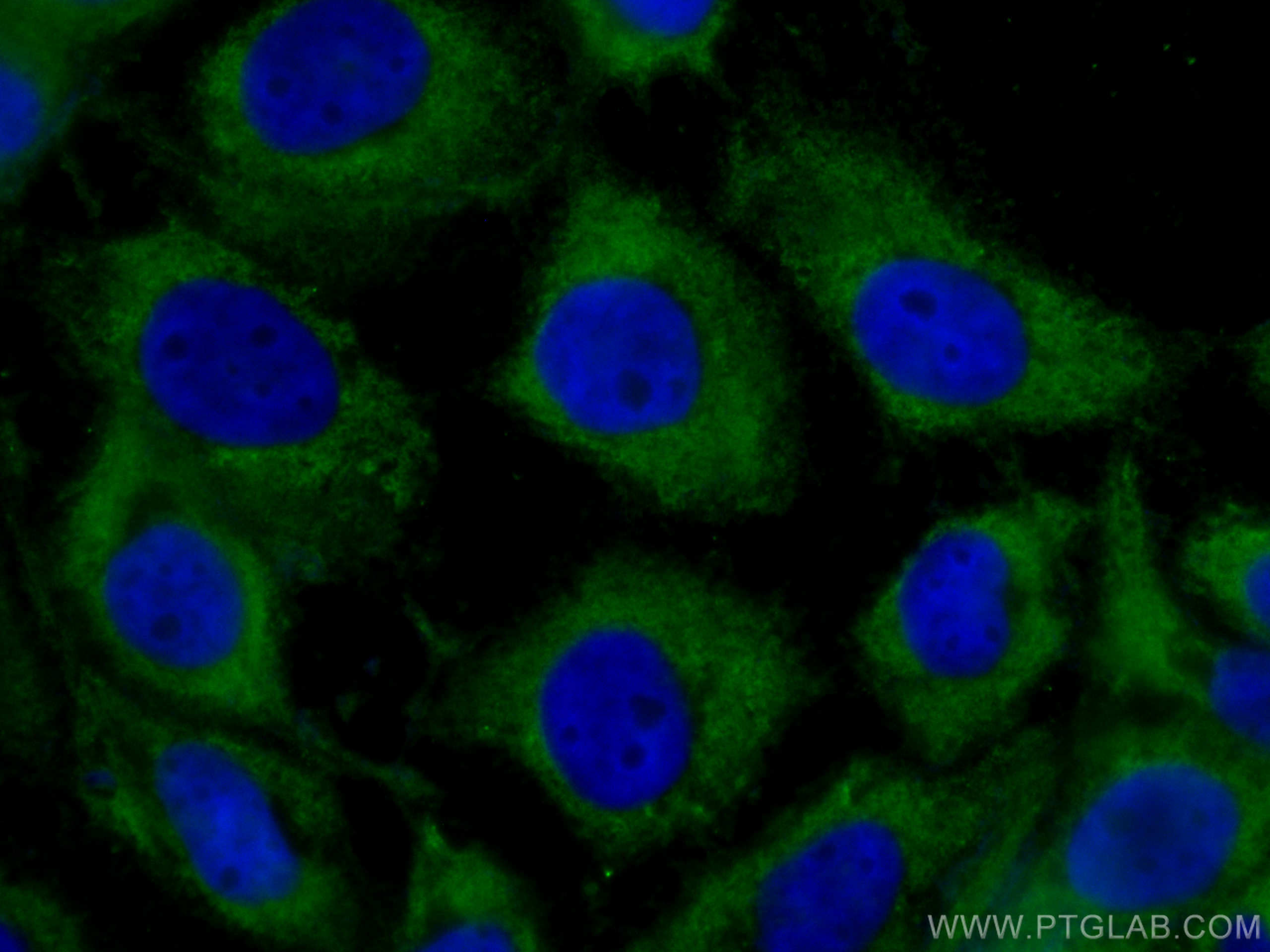 IF Staining of A431 using CL488-67007