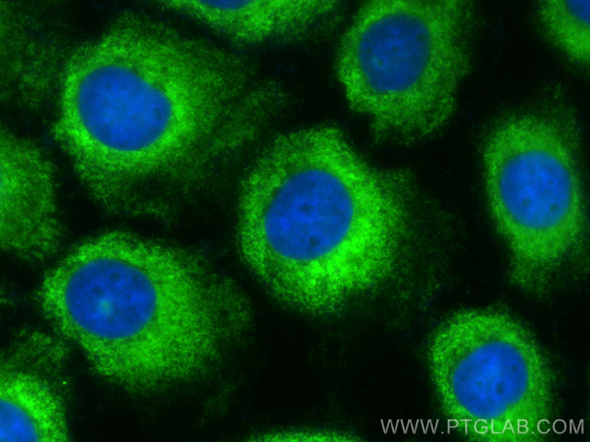 IF Staining of A431 using CL488-67007