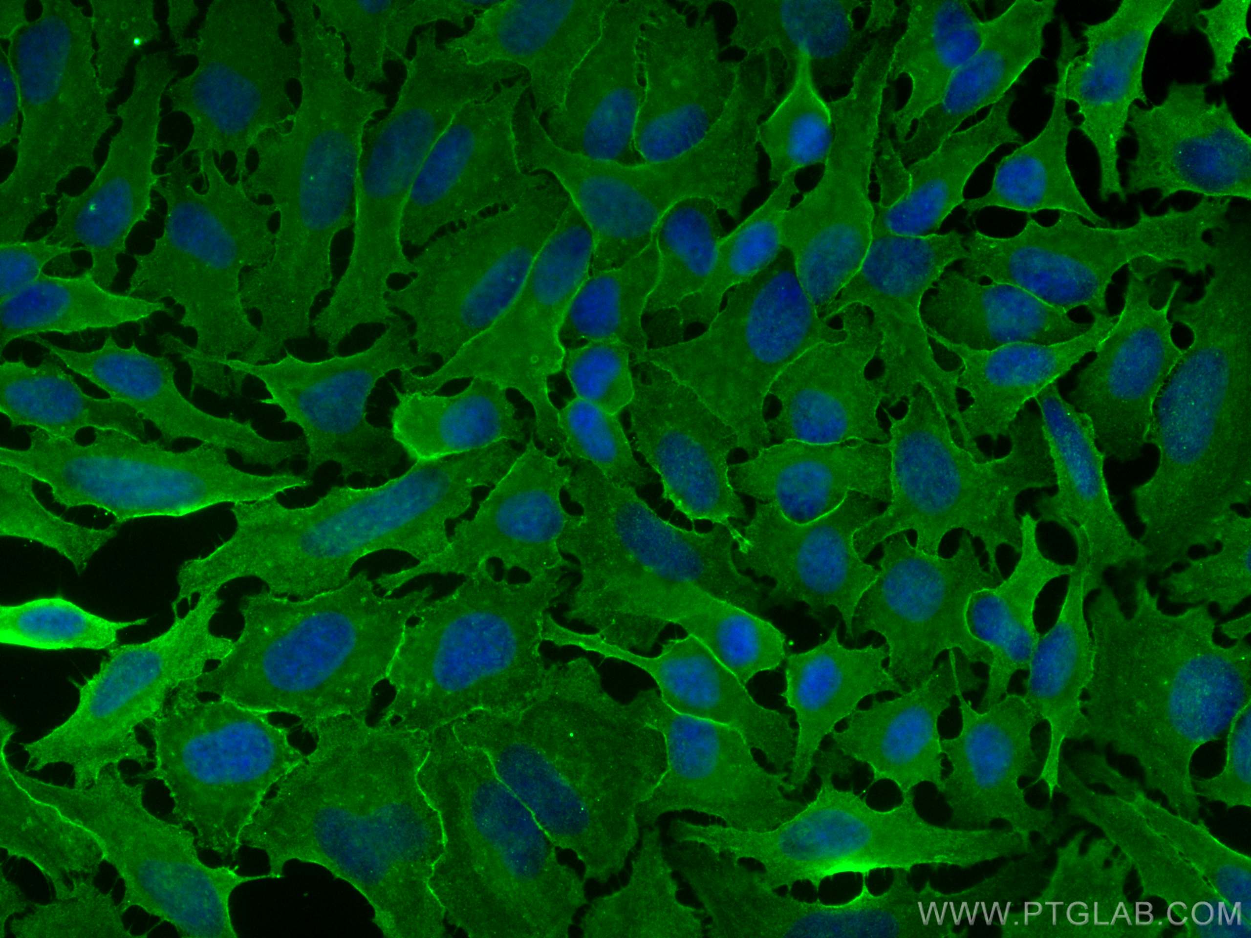 IF Staining of HeLa using 68156-1-Ig