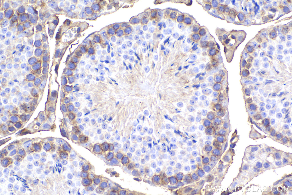 IHC staining of mouse testis using 68156-1-Ig (same clone as 68156-1-PBS) IHC staining of mouse testis using 68156-1-Ig (same clone as 68156-1-PBS)