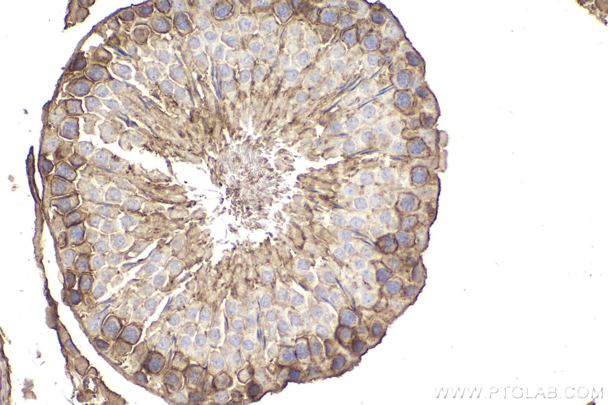IHC staining of rat testis using 68156-1-Ig (same clone as 68156-1-PBS) IHC staining of rat testis using 68156-1-Ig (same clone as 68156-1-PBS)