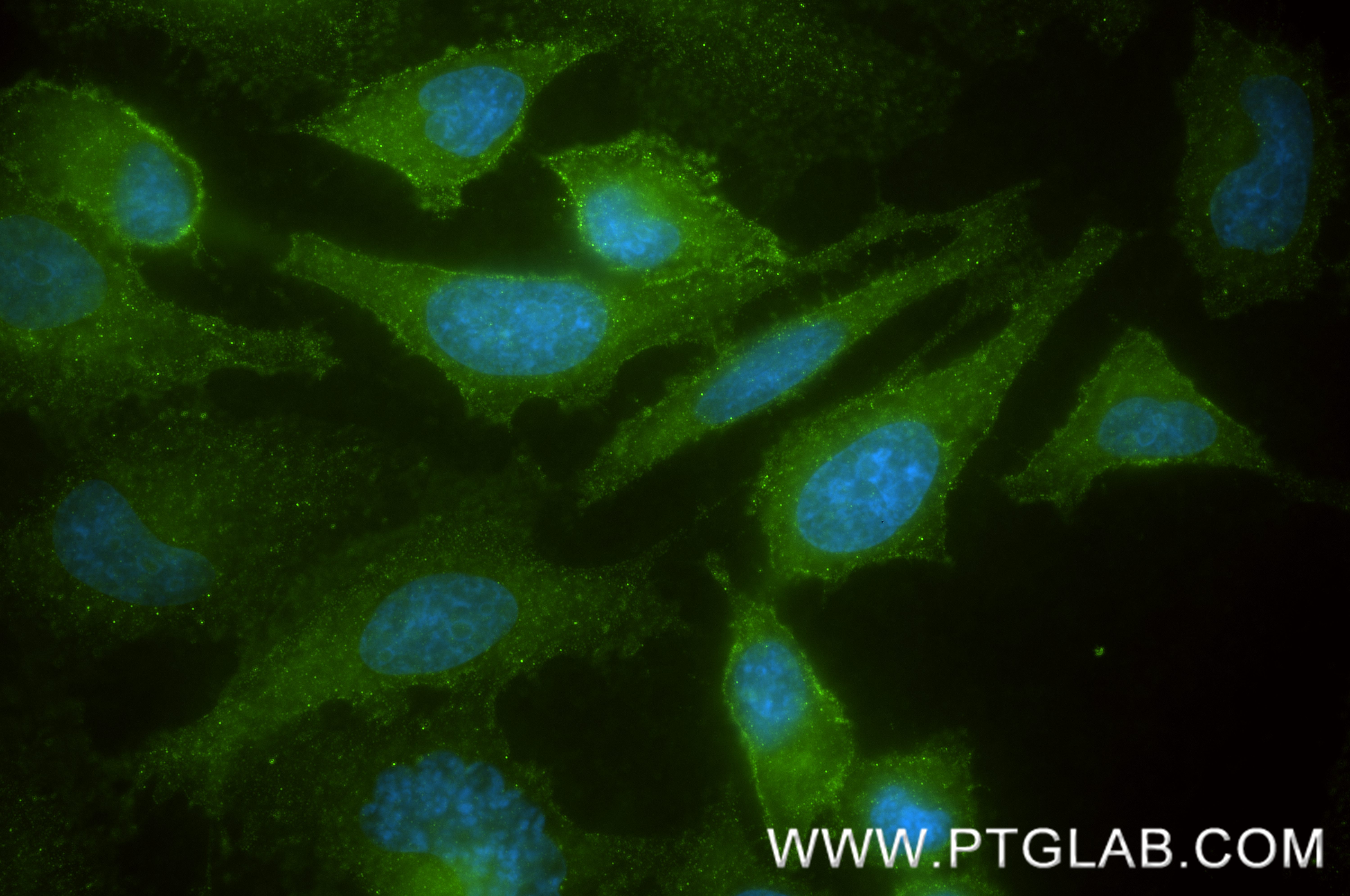 IF Staining of HeLa using 88438-1-RR (same clone as 88438-1-PBS) IF Staining of HeLa using 88438-1-RR (same clone as 88438-1-PBS)