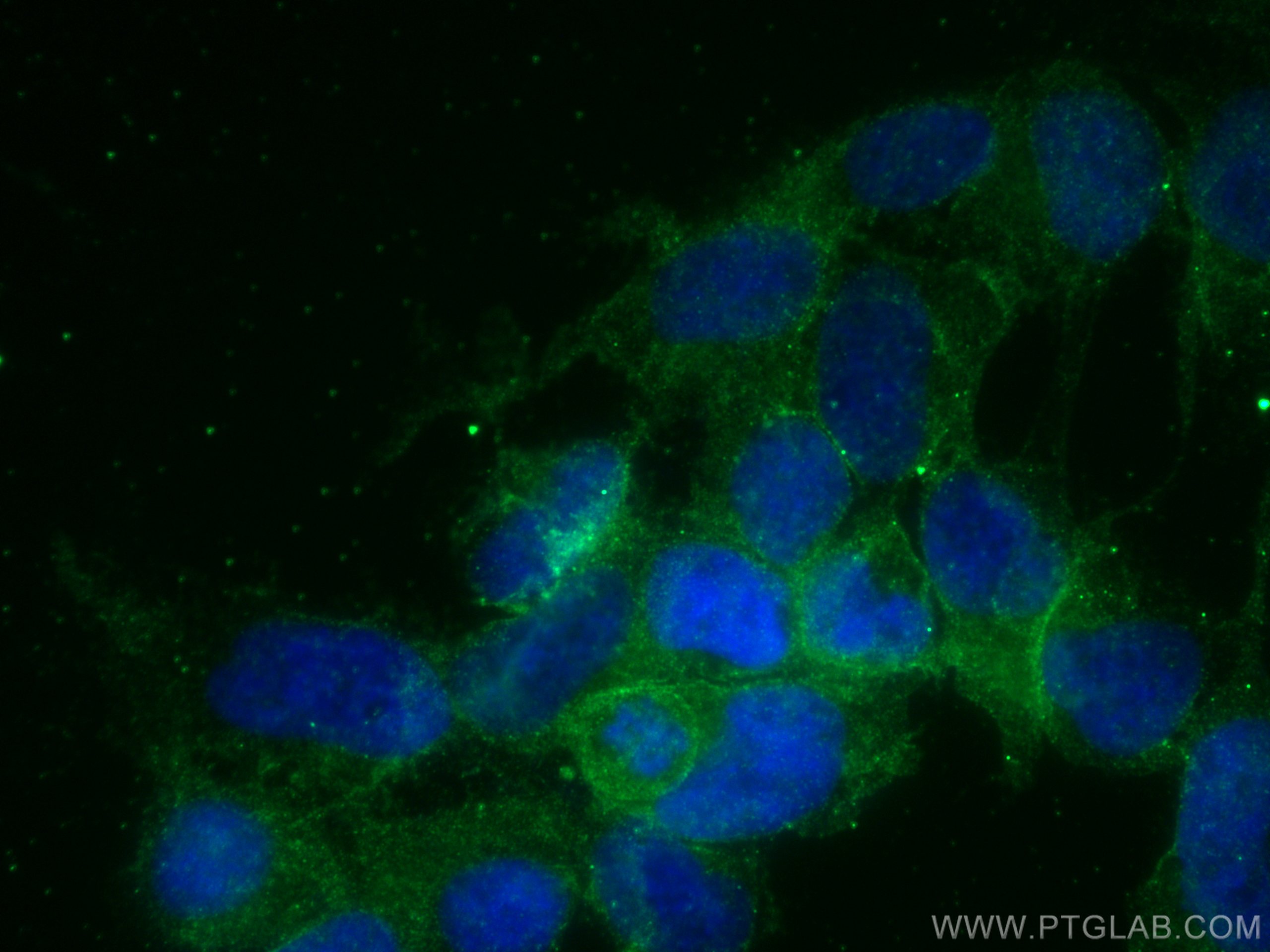 IF Staining of HEK-293 using 13927-1-AP