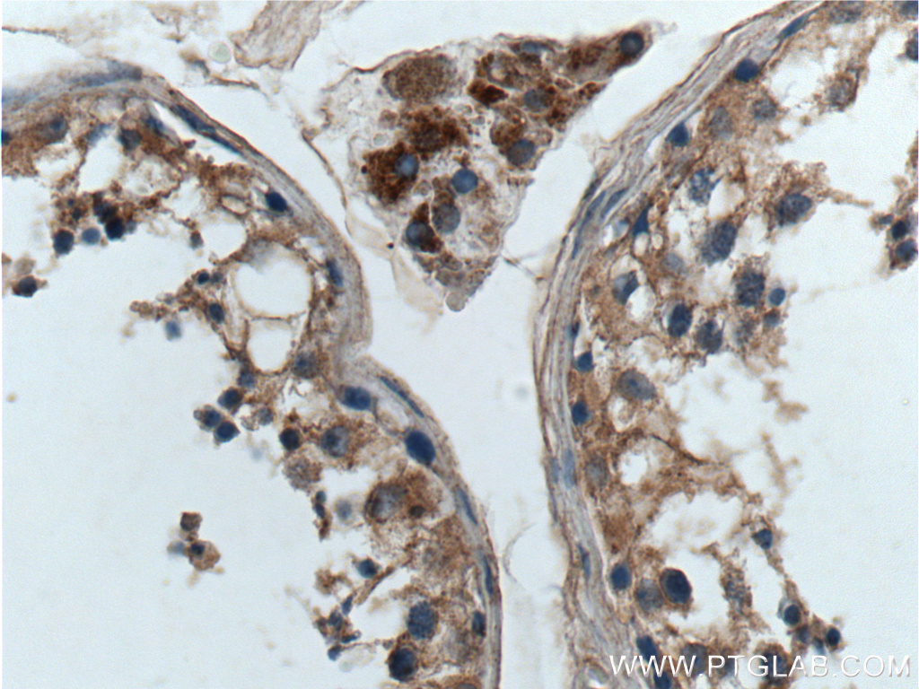 IHC staining of human testis using 13927-1-AP