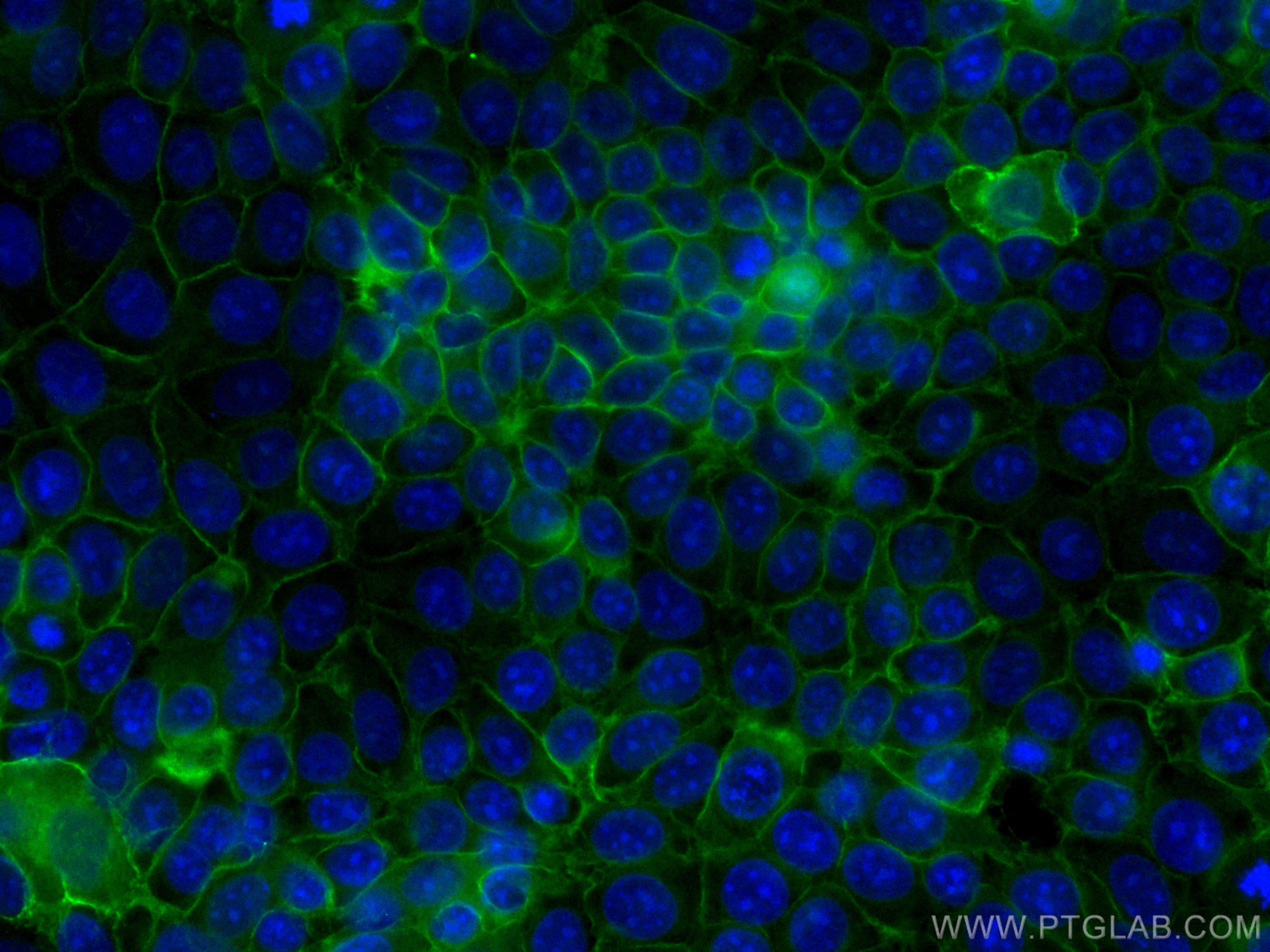 IF Staining of MCF-7 using CL488-66253