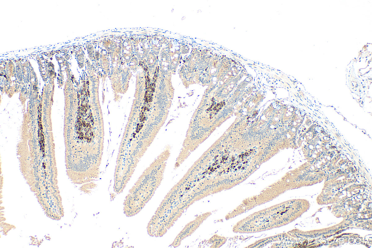 IHC staining of mouse small intestine using 25322-1-AP