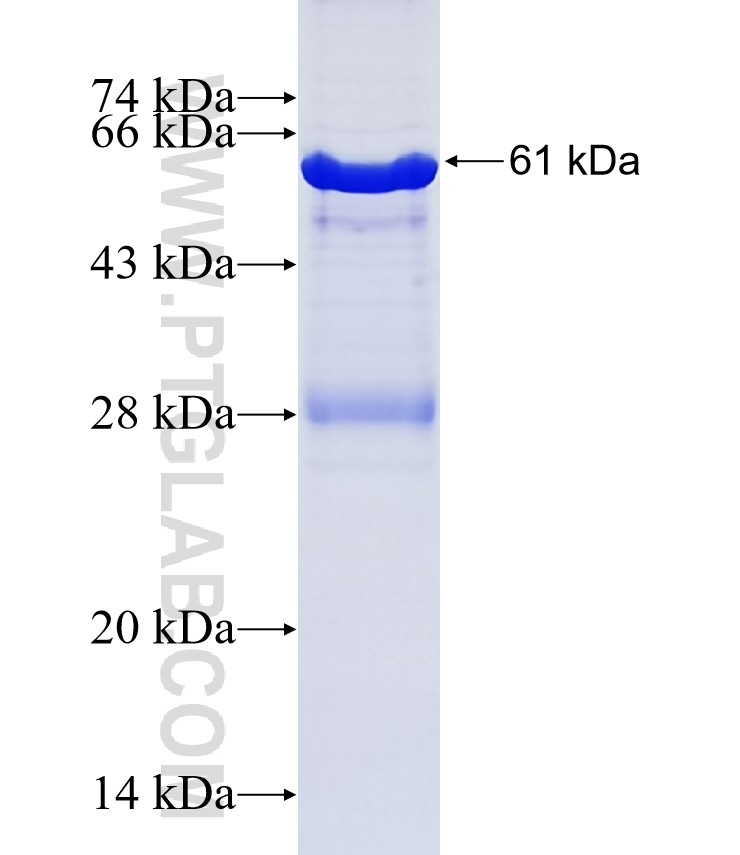 GNB1 fusion protein Ag0313 SDS-PAGE