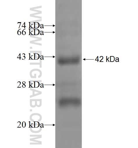 GNB1L fusion protein Ag9468 SDS-PAGE GNB1L fusion protein Ag9468 SDS-PAGE