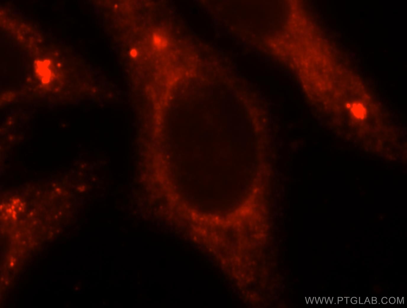 IF Staining of HepG2 using 16090-1-AP