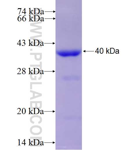 GNB2 fusion protein Ag9260 SDS-PAGE GNB2 fusion protein Ag9260 SDS-PAGE