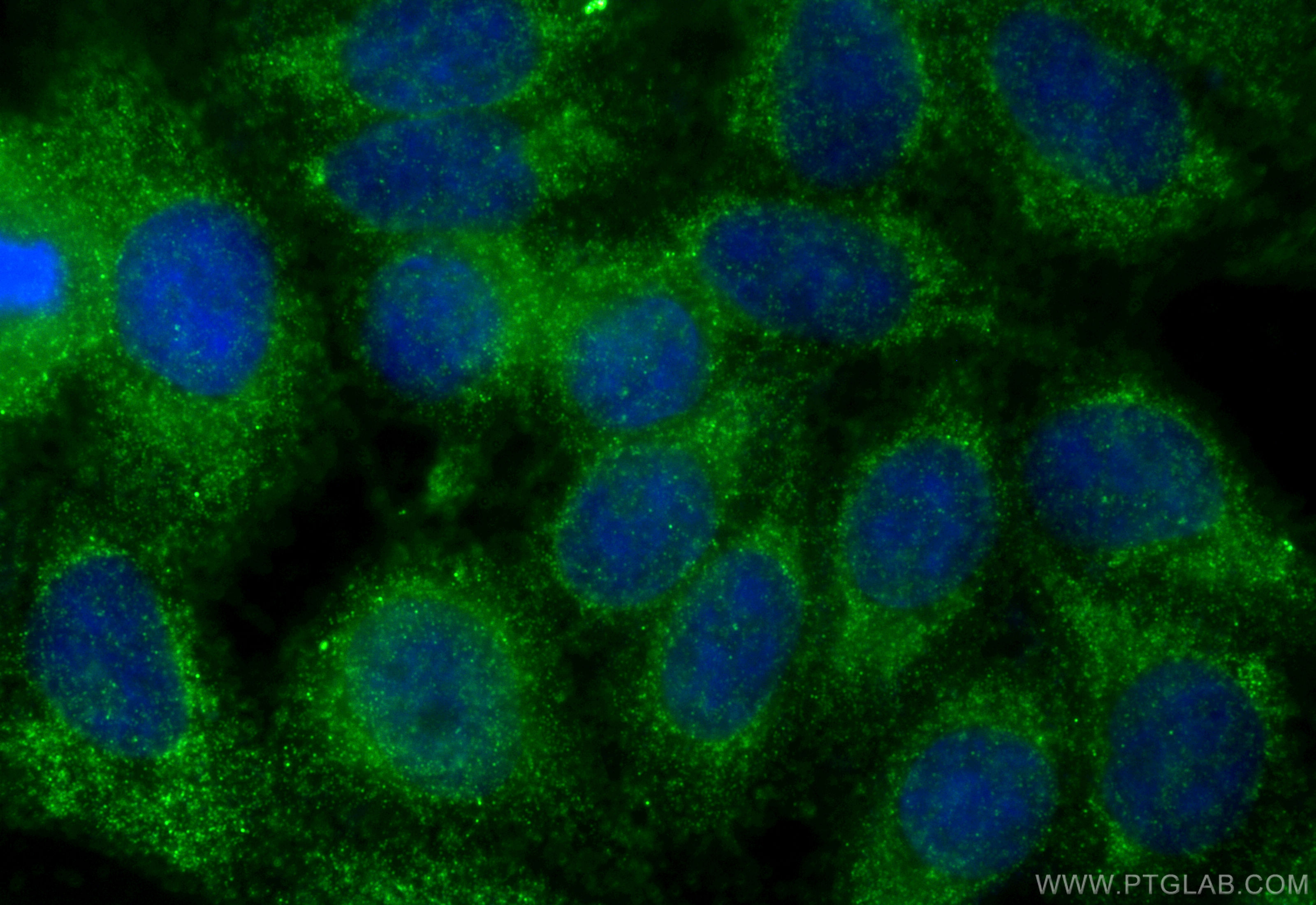 IF Staining of HepG2 using 10081-1-AP (same clone as 10081-1-PBS)