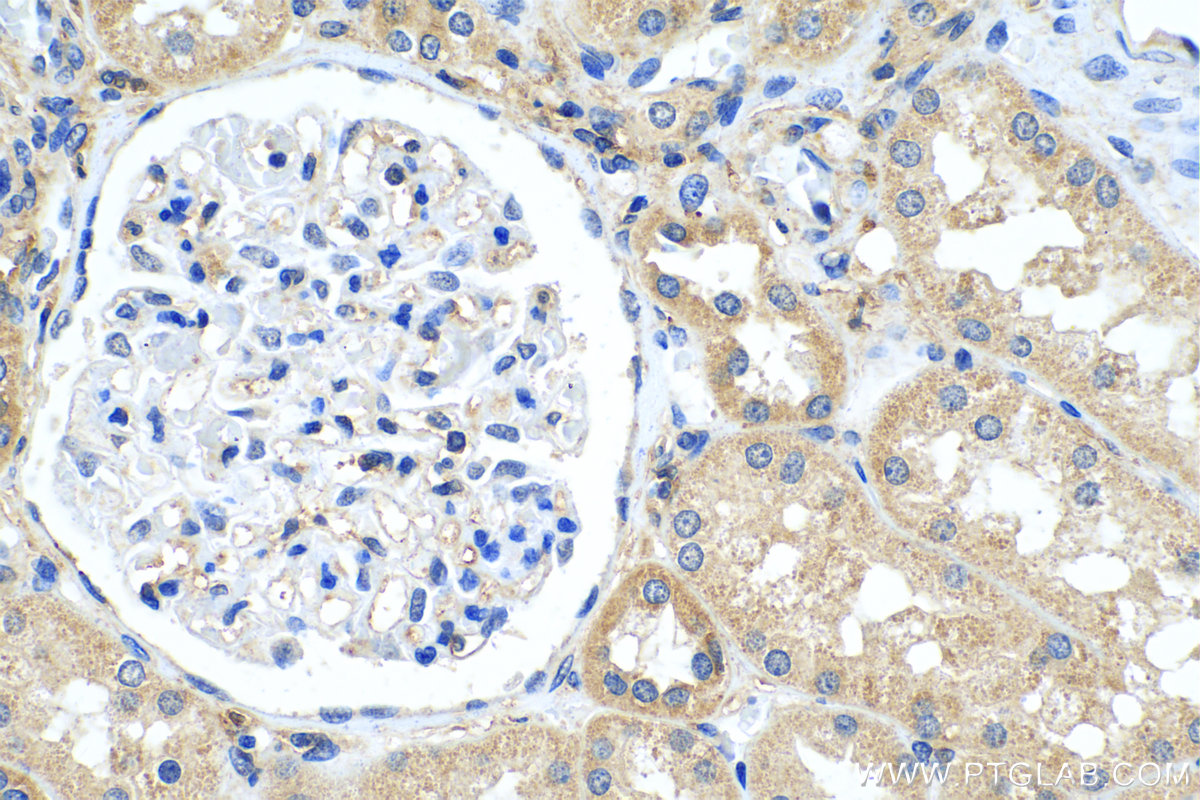 IHC staining of human kidney using 15388-1-AP