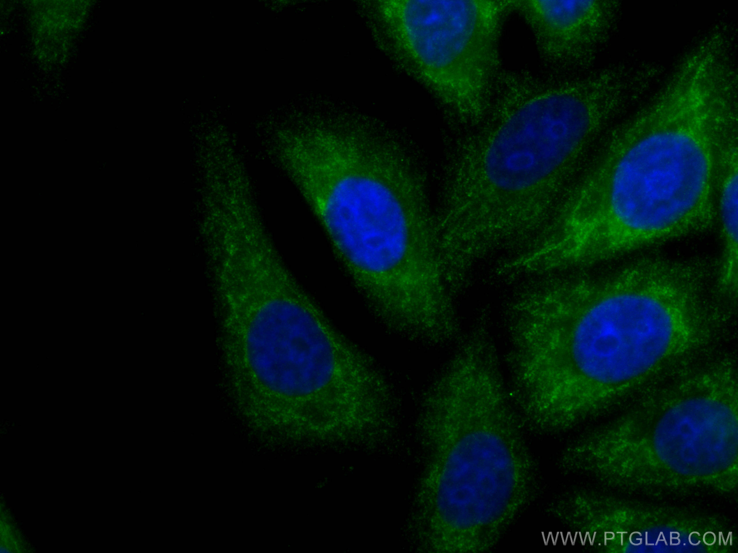 IF Staining of HepG2 using 67497-1-Ig (same clone as 67497-1-PBS)