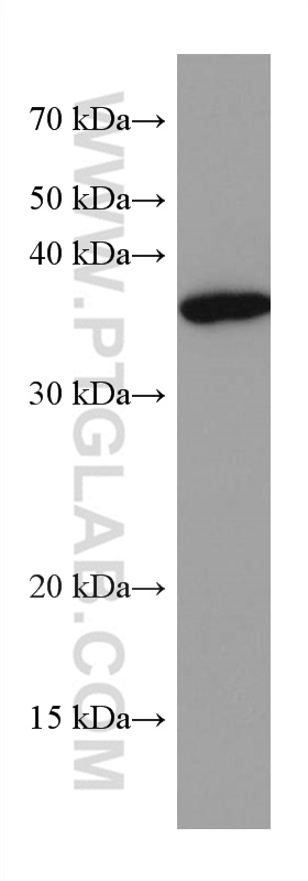 WB analysis of L02 using 67497-1-Ig