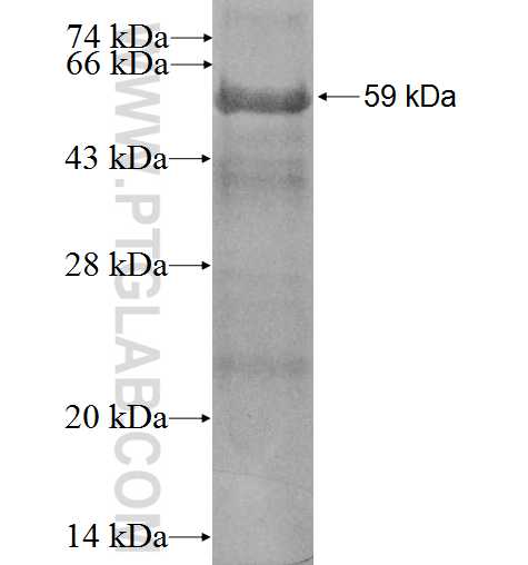 GNB3 fusion protein Ag0127 SDS-PAGE