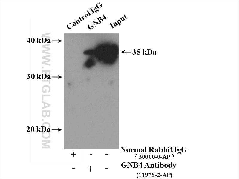 IP experiment of mouse brain using 11978-2-AP (same clone as 11978-2-PBS)
