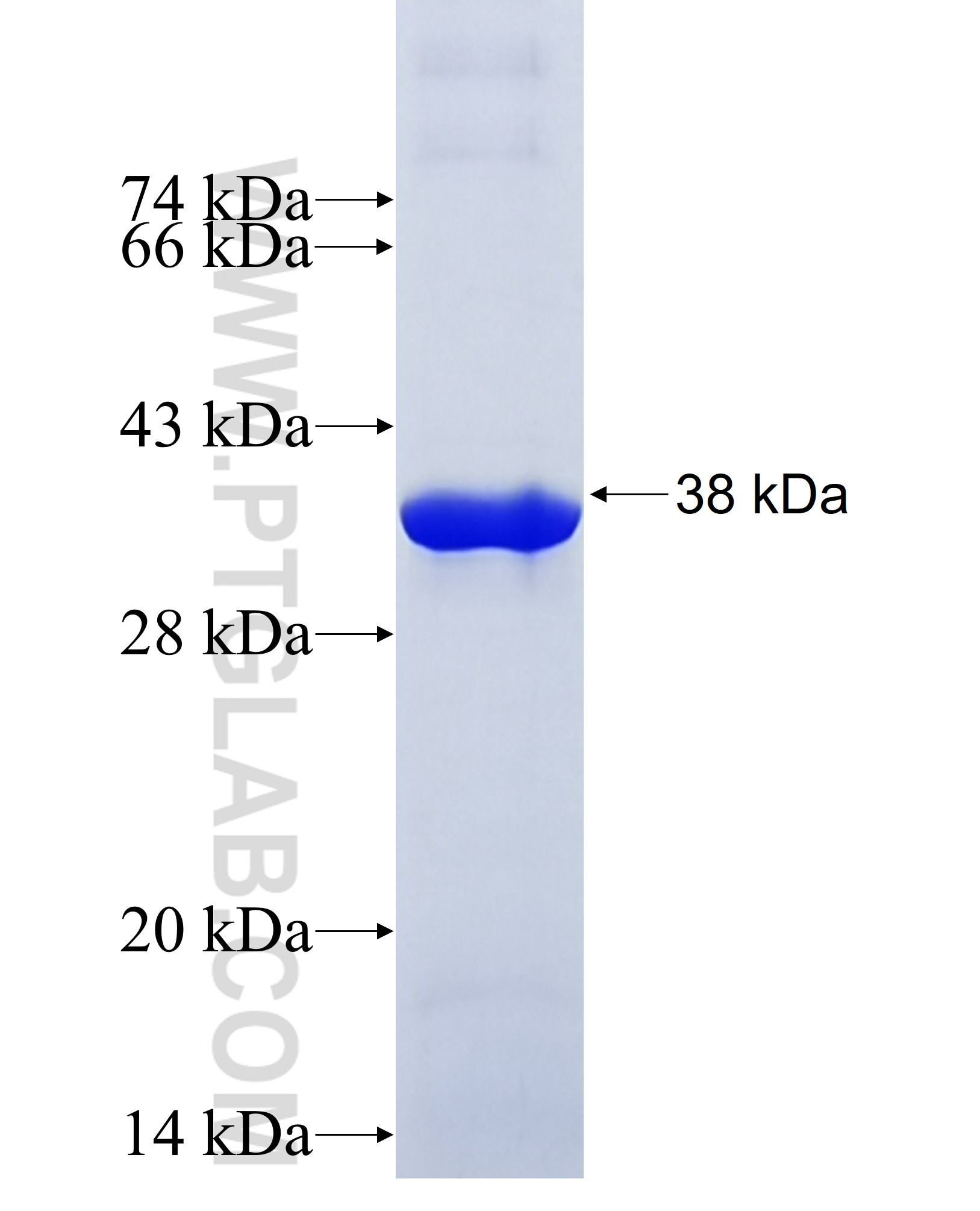 GNB4 fusion protein Ag32664 SDS-PAGE