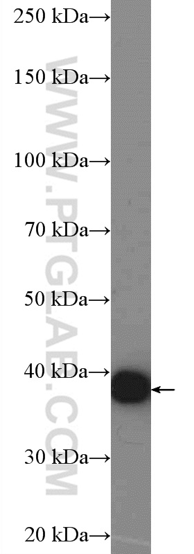 WB analysis of mouse brain using 11045-2-AP