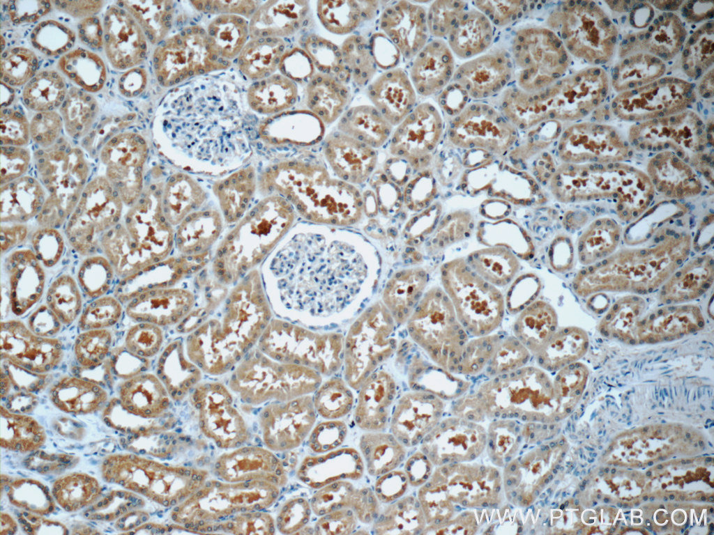 IHC staining of human kidney using 25079-1-AP