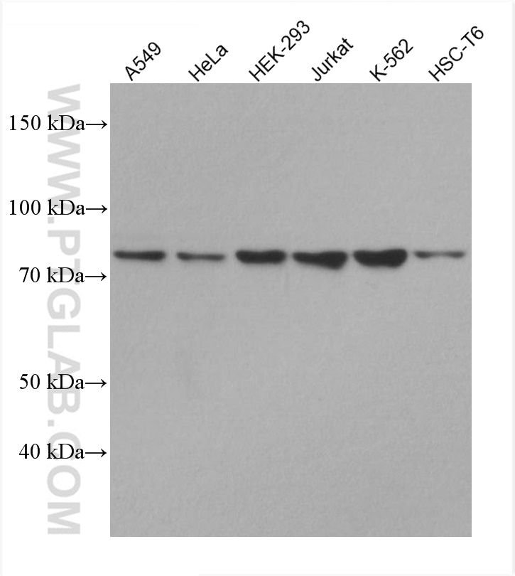 WB analysis using 67649-1-Ig