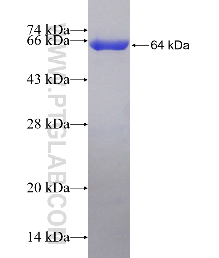 GNE fusion protein Ag18689 SDS-PAGE