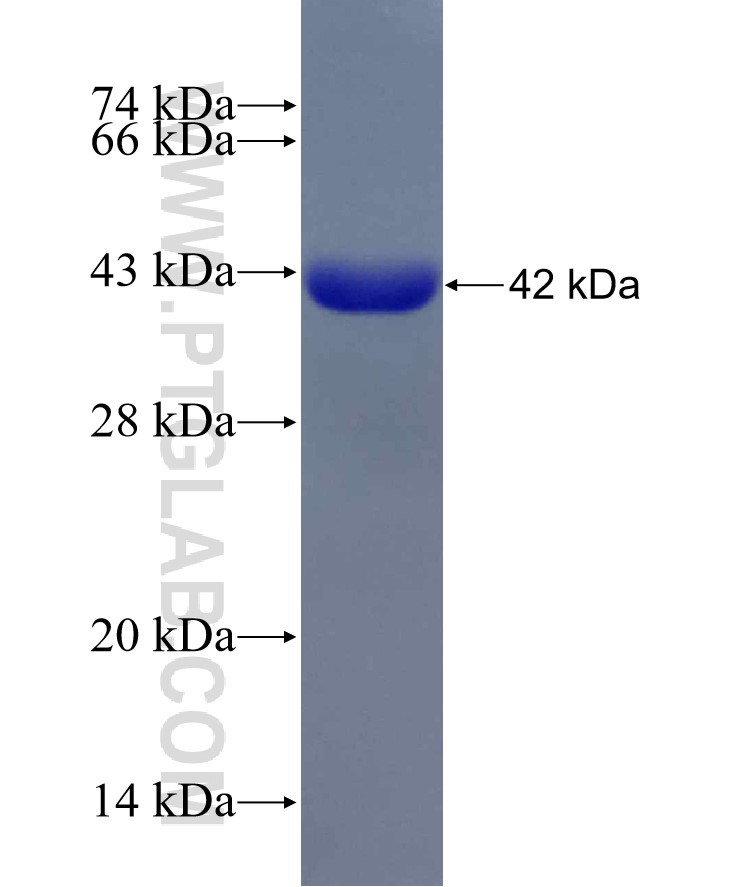 GNE fusion protein Ag18702 SDS-PAGE