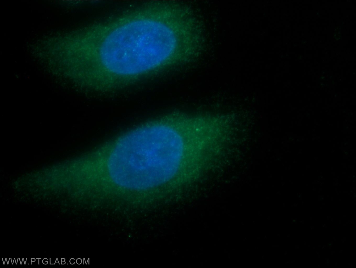 IF Staining of HeLa using 11884-1-AP (same clone as 11884-1-PBS)