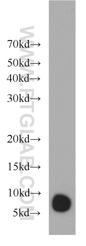 WB analysis of mouse eye using 11884-1-AP