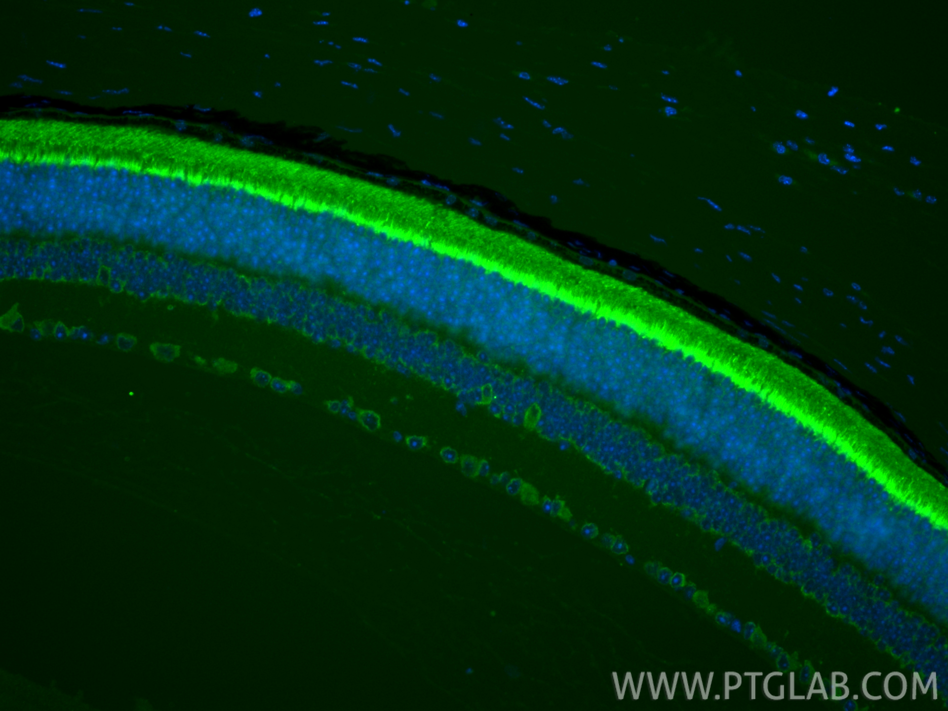 IF Staining of mouse eye using 11988-1-AP IF Staining of mouse eye using 11988-1-AP