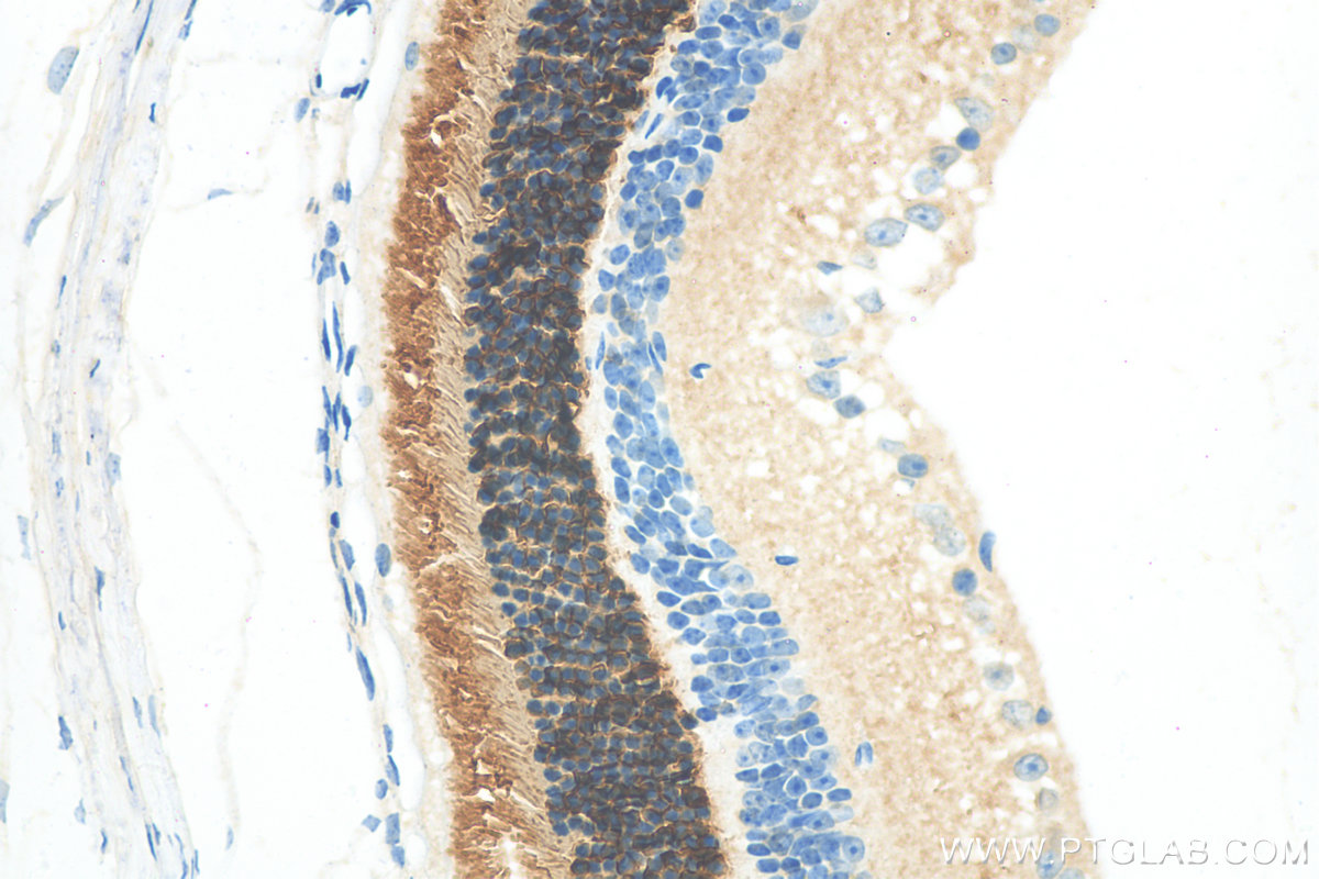 IHC staining of mouse eye using 11988-1-AP